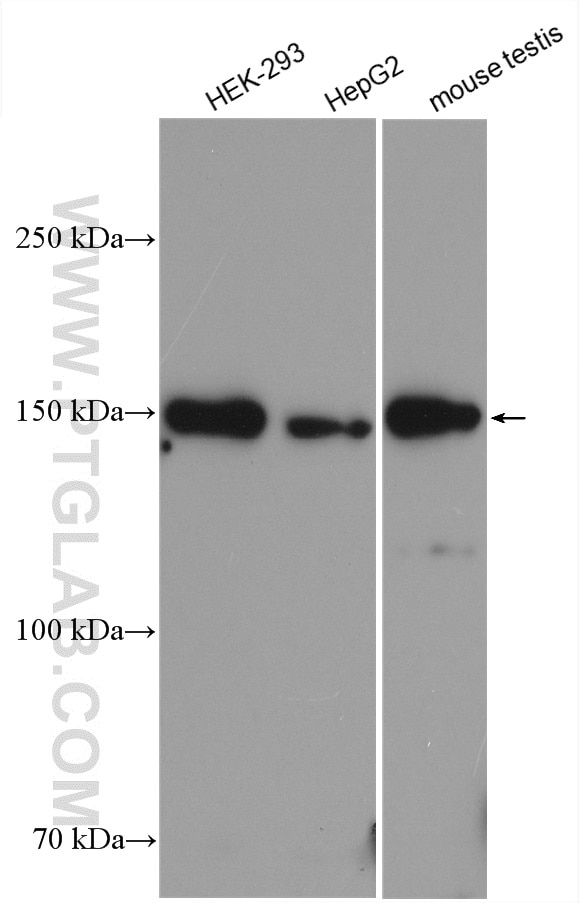 Western Blot (WB) analysis of various lysates using TTC37 Polyclonal antibody (24594-1-AP)