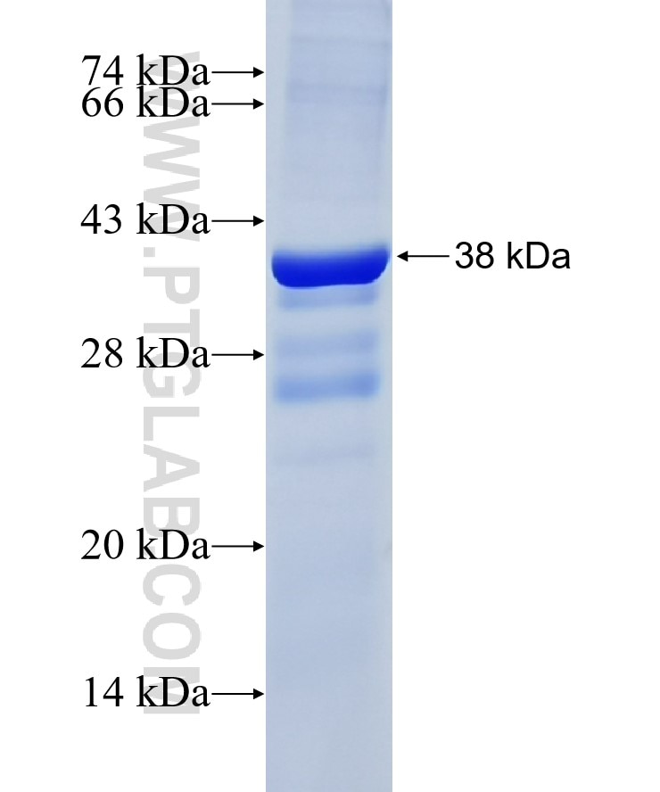 TTC37 fusion protein Ag18442 SDS-PAGE
