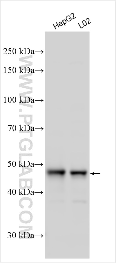 Western Blot (WB) analysis of various lysates using TTC38 Polyclonal antibody (25452-1-AP)