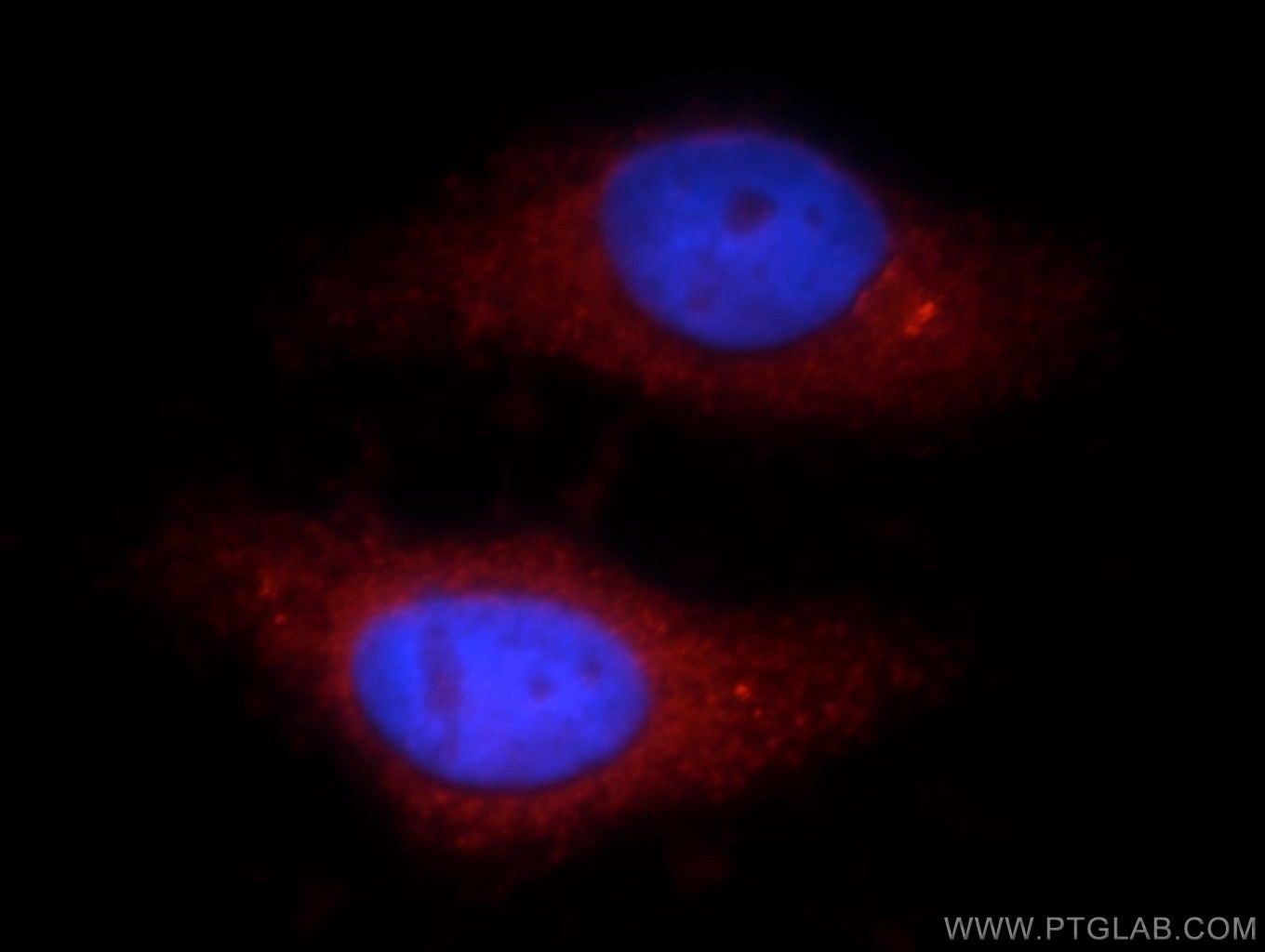 Immunofluorescence (IF) / fluorescent staining of HepG2 cells using TTC39A Polyclonal antibody (21323-1-AP)