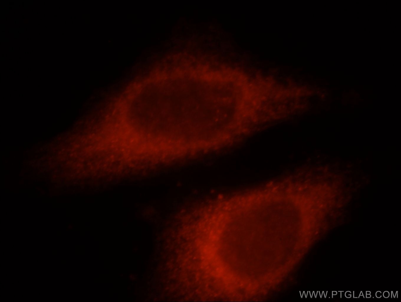 Immunofluorescence (IF) / fluorescent staining of HeLa cells using TTC39A Polyclonal antibody (21323-1-AP)