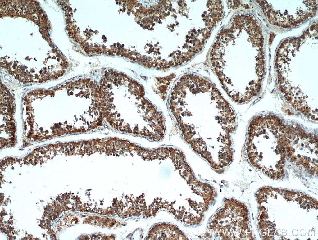 Immunohistochemistry (IHC) staining of human testis tissue using TTC39A Polyclonal antibody (21323-1-AP)