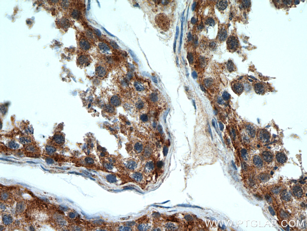 Immunohistochemistry (IHC) staining of human testis tissue using TTC39A Polyclonal antibody (21323-1-AP)