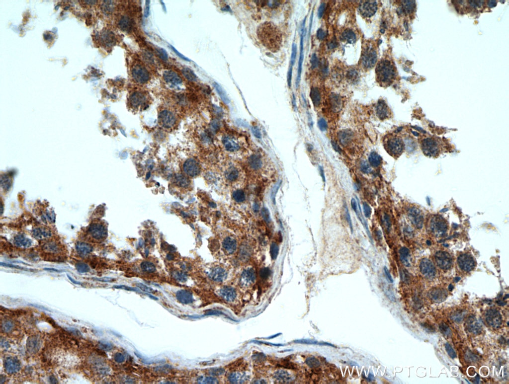 IHC staining of human testis using 21323-1-AP