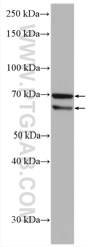 Western Blot (WB) analysis of mouse liver tissue using TTC39A Polyclonal antibody (21323-1-AP)