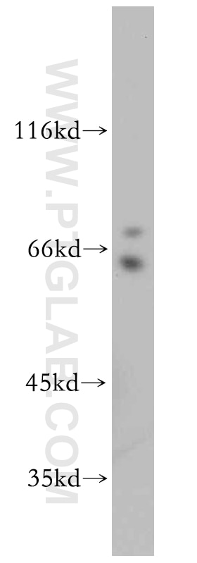 Western Blot (WB) analysis of MCF-7 cells using TTC39A Polyclonal antibody (21323-1-AP)