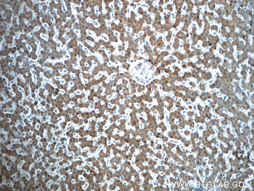 Immunohistochemistry (IHC) staining of human liver tissue using TTC39B Polyclonal antibody (23432-1-AP)