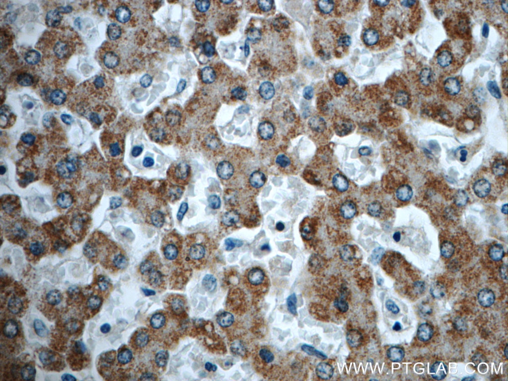 Immunohistochemistry (IHC) staining of human liver tissue using TTC39B Polyclonal antibody (23432-1-AP)