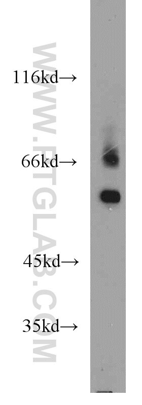 Western Blot (WB) analysis of mouse testis tissue using TTC39B Polyclonal antibody (23432-1-AP)
