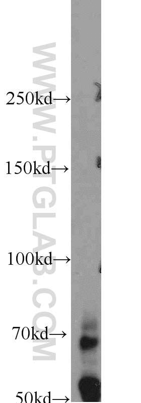 Western Blot (WB) analysis of mouse testis tissue using TTC39B Polyclonal antibody (23432-1-AP)