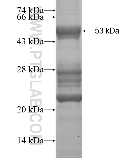 TTC39B fusion protein Ag20081 SDS-PAGE
