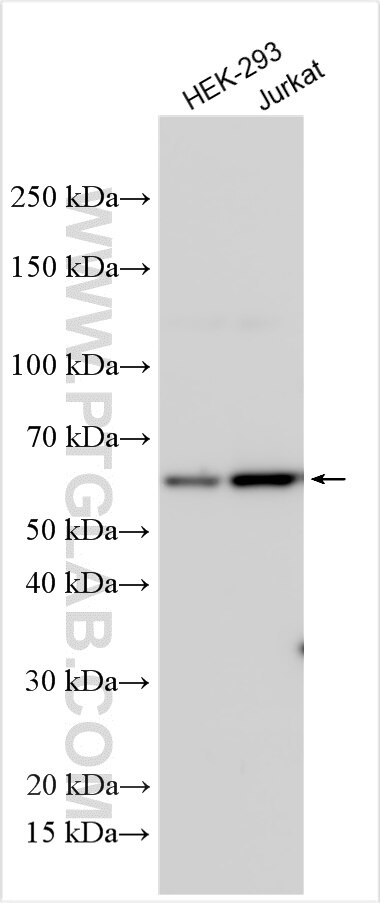 Western Blot (WB) analysis of various lysates using TTC39C Polyclonal antibody (24887-1-AP)