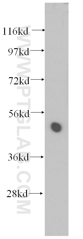 Western Blot (WB) analysis of HeLa cells using TTC4 Polyclonal antibody (11878-1-AP)