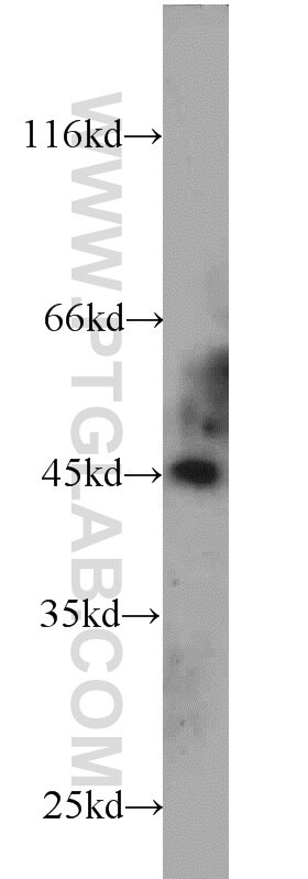 Western Blot (WB) analysis of HeLa cells using TTC4 Polyclonal antibody (11878-1-AP)