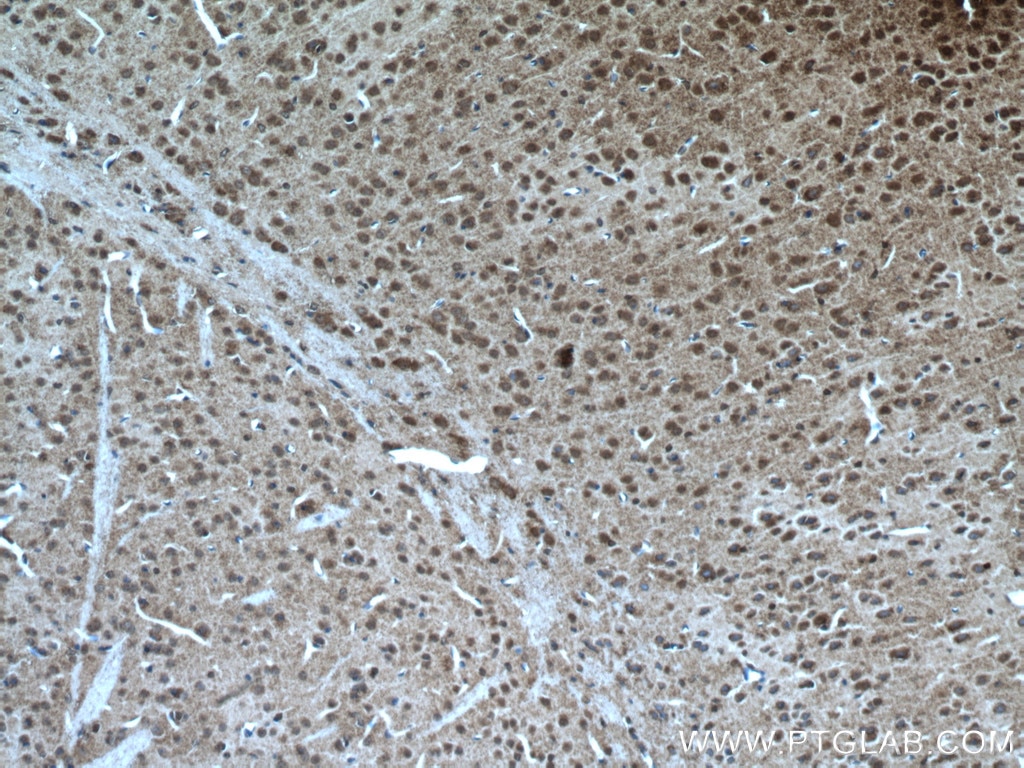 Immunohistochemistry (IHC) staining of mouse brain tissue using TTC5 Polyclonal antibody (26112-1-AP)