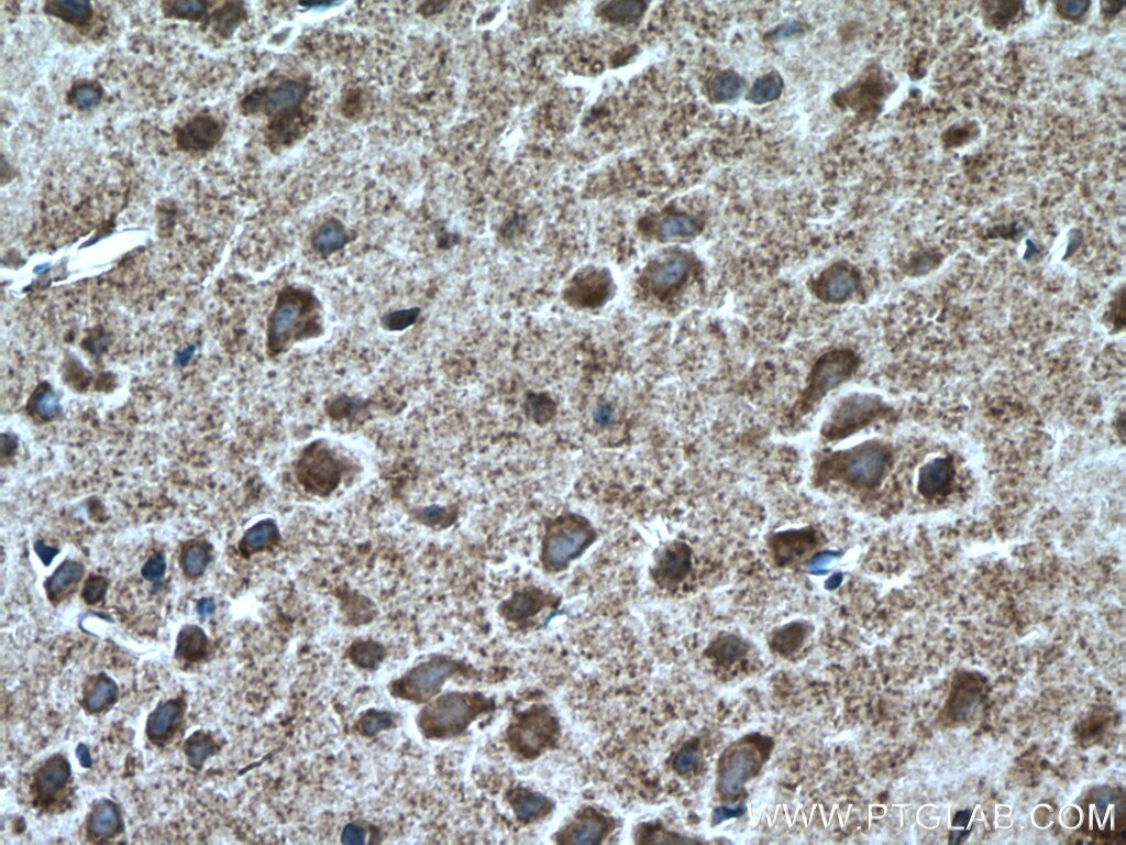 Immunohistochemistry (IHC) staining of mouse brain tissue using TTC5 Polyclonal antibody (26112-1-AP)