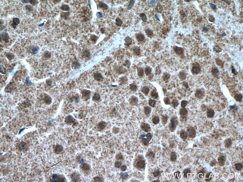 Immunohistochemistry (IHC) staining of mouse brain tissue using TTC5 Polyclonal antibody (26112-1-AP)