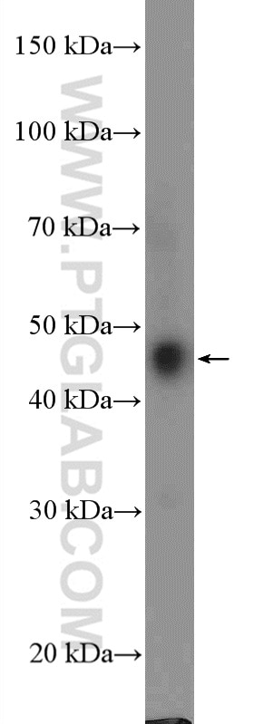 Western Blot (WB) analysis of Jurkat cells using TTC5 Polyclonal antibody (26112-1-AP)