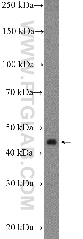 Western Blot (WB) analysis of Jurkat cells using TTC5 Polyclonal antibody (26112-1-AP)