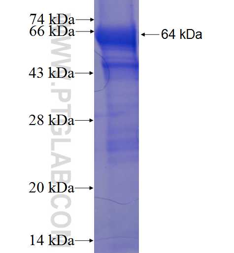 TTC5 fusion protein Ag23523 SDS-PAGE