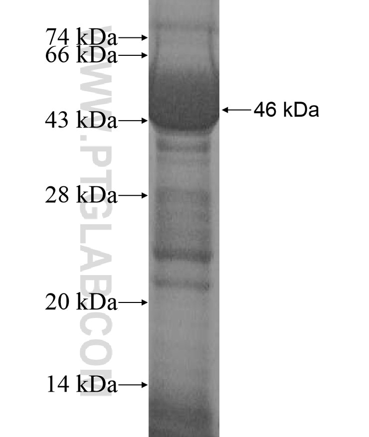 TTC6 fusion protein Ag17277 SDS-PAGE