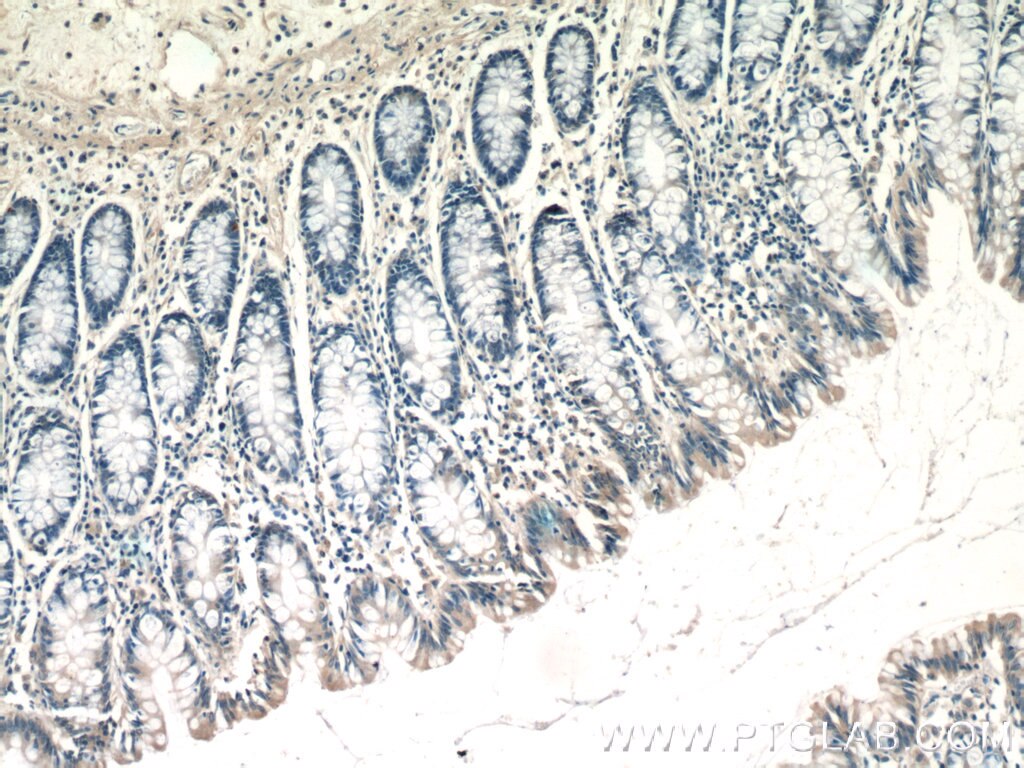 Immunohistochemistry (IHC) staining of human colon tissue using TTC7A Polyclonal antibody (21600-1-AP)