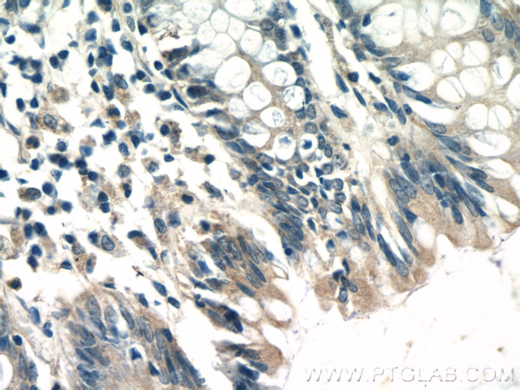 Immunohistochemistry (IHC) staining of human colon tissue using TTC7A Polyclonal antibody (21600-1-AP)