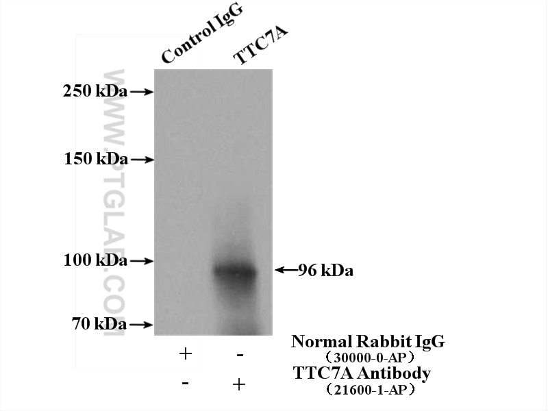 Immunoprecipitation (IP) experiment of K-562 cells using TTC7A Polyclonal antibody (21600-1-AP)