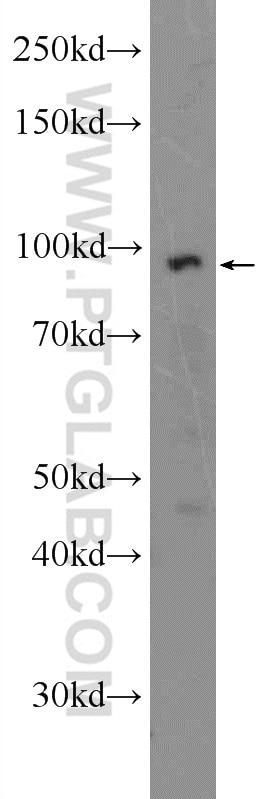 WB analysis of PC-3 using 21600-1-AP