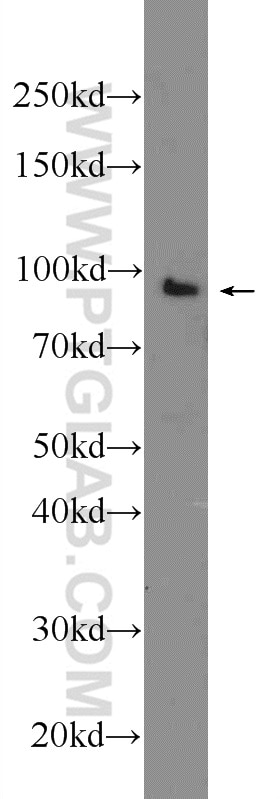 Western Blot (WB) analysis of K-562 cells using TTC7A Polyclonal antibody (21600-1-AP)