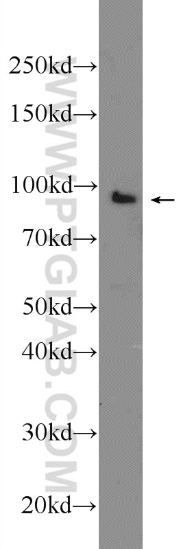 Western Blot (WB) analysis of K-562 cells using TTC7A Polyclonal antibody (21600-1-AP)