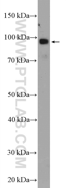 Western Blot (WB) analysis of mouse colon tissue using TTC7A Polyclonal antibody (21600-1-AP)