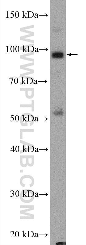 Western Blot (WB) analysis of mouse small intestine tissue using TTC7A Polyclonal antibody (21600-1-AP)