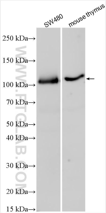 Western Blot (WB) analysis of various lysates using TTC7A Polyclonal antibody (21600-1-AP)