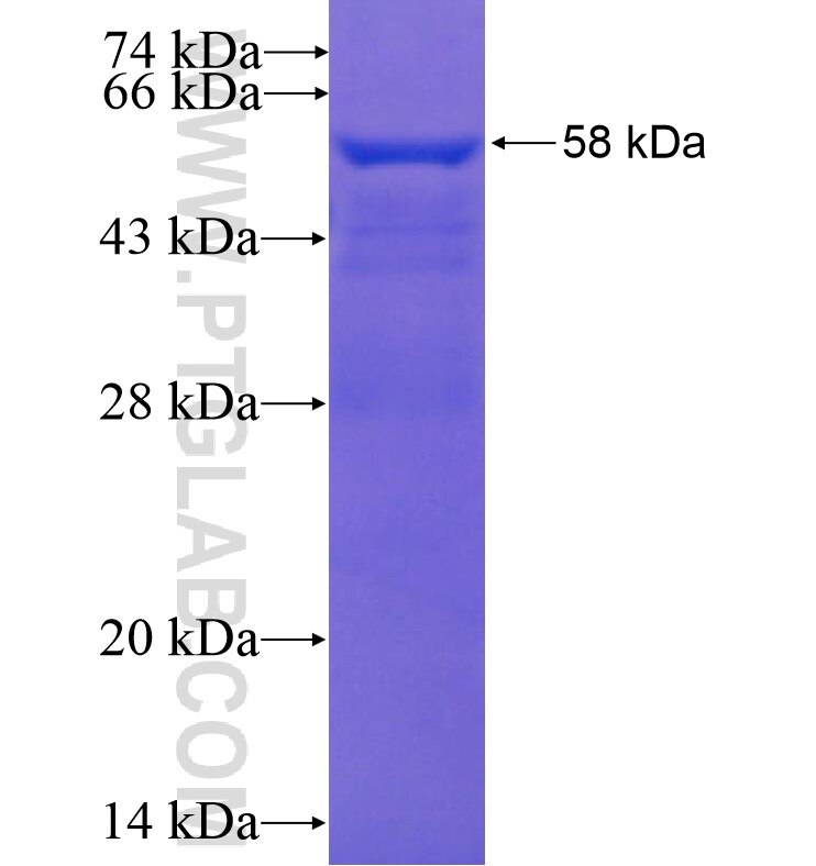 TTC7A fusion protein Ag16212 SDS-PAGE