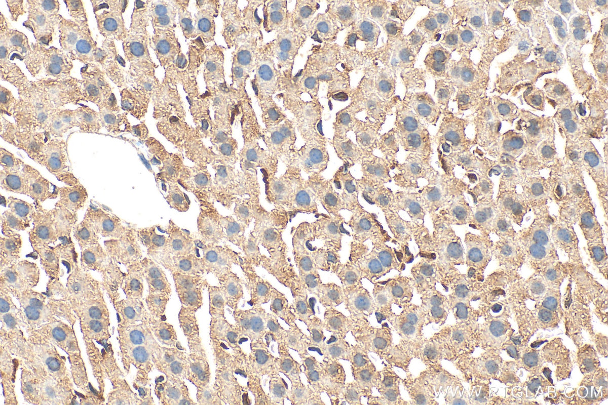 Immunohistochemistry (IHC) staining of mouse liver tissue using TTC7B Polyclonal antibody (25713-1-AP)