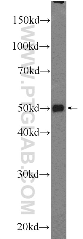 Western Blot (WB) analysis of mouse liver tissue using TTC7B Polyclonal antibody (25713-1-AP)