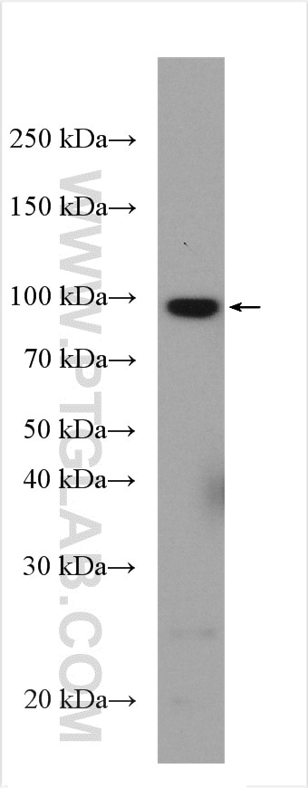 Western Blot (WB) analysis of mouse brain tissue using TTC7B Polyclonal antibody (25713-1-AP)