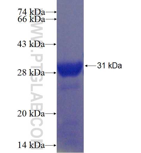 TTC7B fusion protein Ag22388 SDS-PAGE