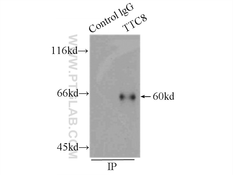 Immunoprecipitation (IP) experiment of HeLa cells using BBS8 Polyclonal antibody (12505-1-AP)