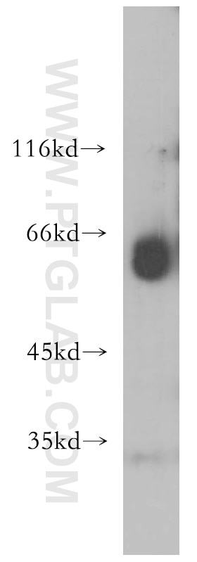 Western Blot (WB) analysis of human lung tissue using BBS8 Polyclonal antibody (12505-1-AP)