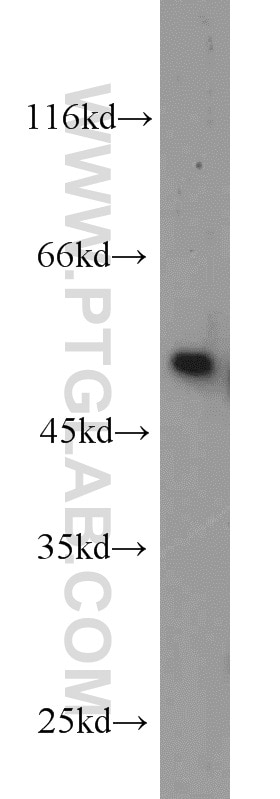 Western Blot (WB) analysis of mouse testis tissue using BBS8 Polyclonal antibody (12505-1-AP)