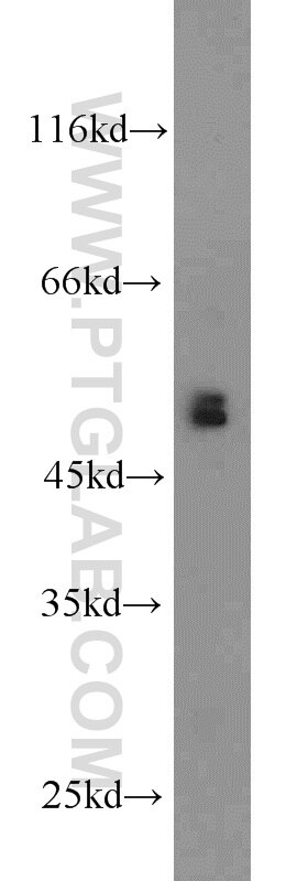 Western Blot (WB) analysis of mouse testis tissue using BBS8 Polyclonal antibody (12505-1-AP)