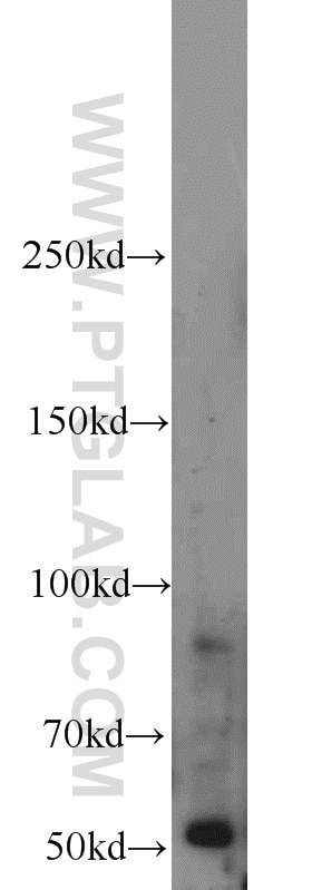 Western Blot (WB) analysis of NIH/3T3 cells using BBS8 Polyclonal antibody (12505-1-AP)