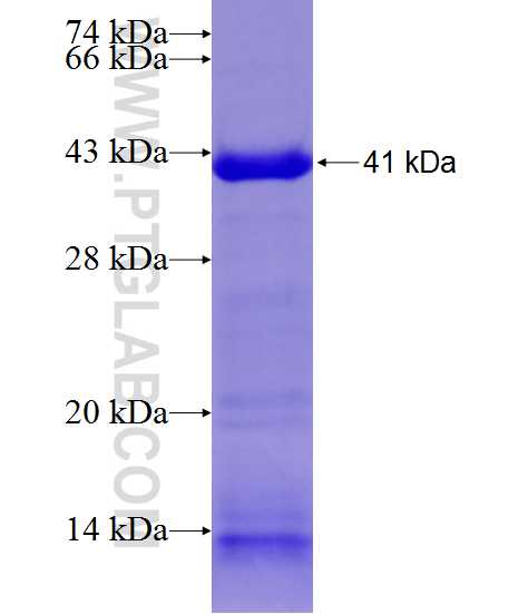 TTC8 fusion protein Ag21189 SDS-PAGE