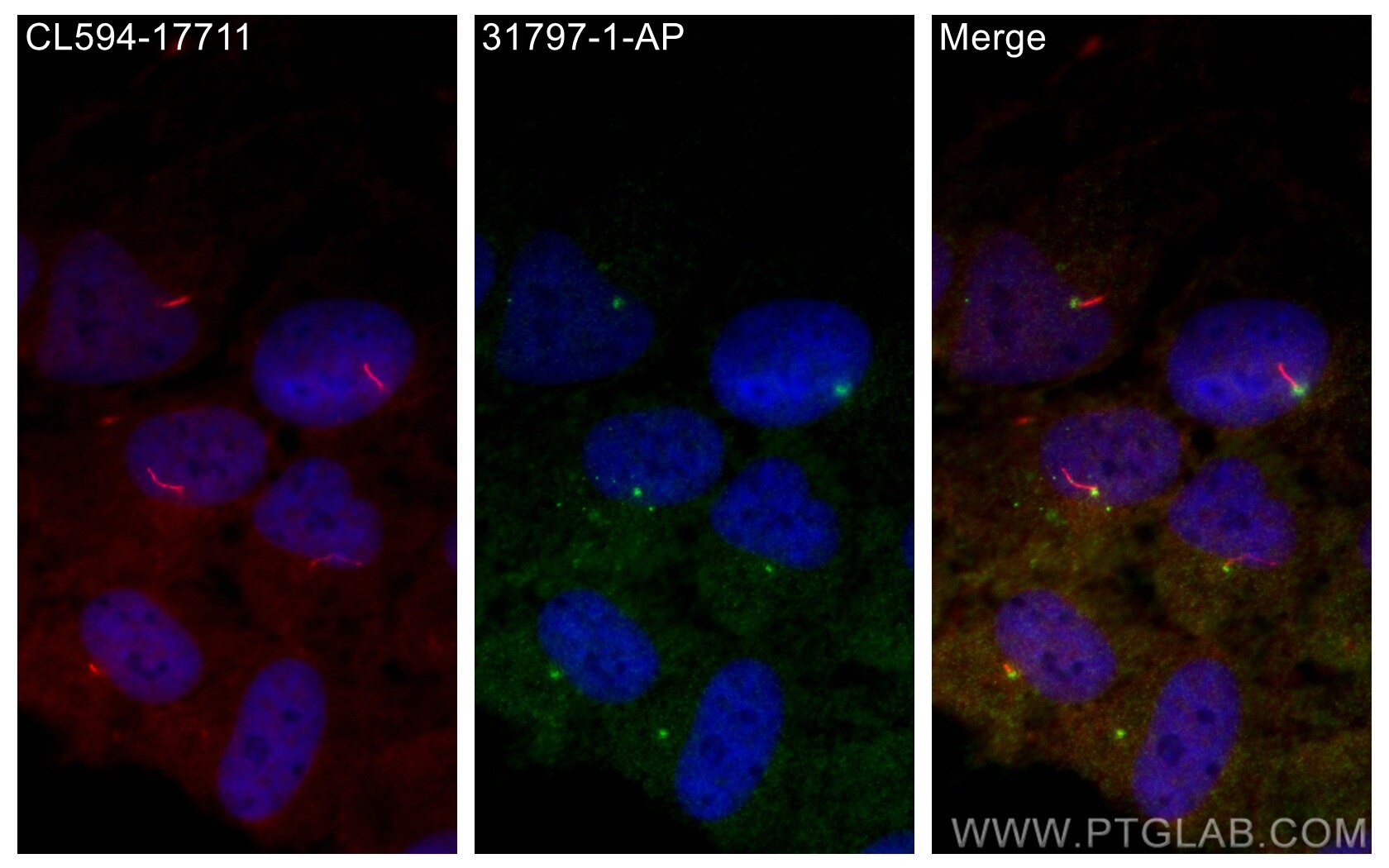 Immunofluorescence (IF) / fluorescent staining of hTERT-RPE1 cells using TTC9C Polyclonal antibody (31797-1-AP)