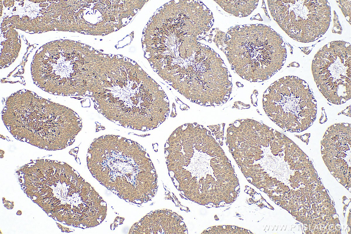 Immunohistochemistry (IHC) staining of mouse testis tissue using TTC9C Polyclonal antibody (31797-1-AP)