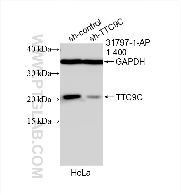 Western Blot (WB) analysis of HeLa cells using TTC9C Polyclonal antibody (31797-1-AP)