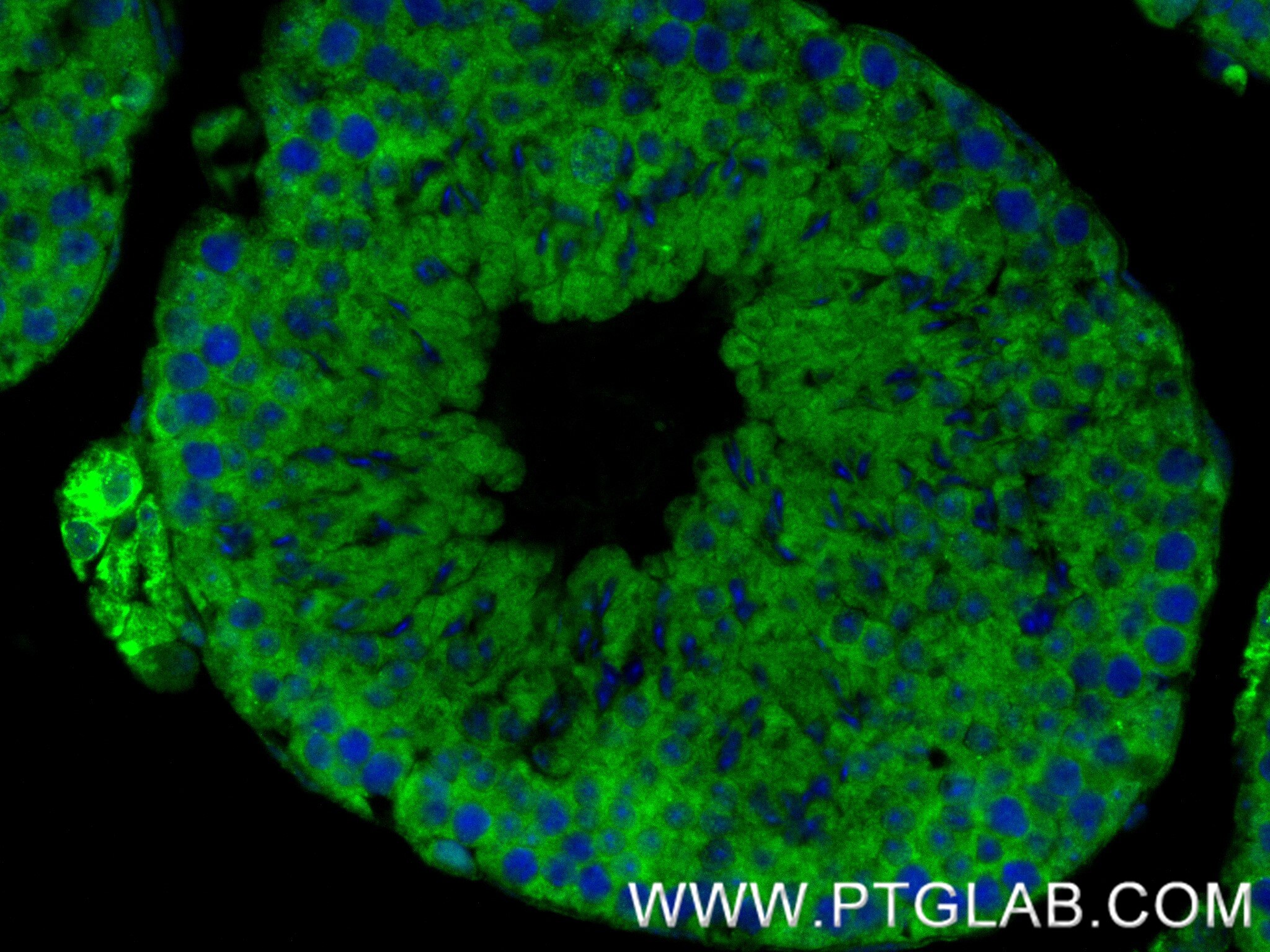 Immunofluorescence (IF) / fluorescent staining of mouse testis tissue using TTC9C Recombinant antibody (84611-2-RR)