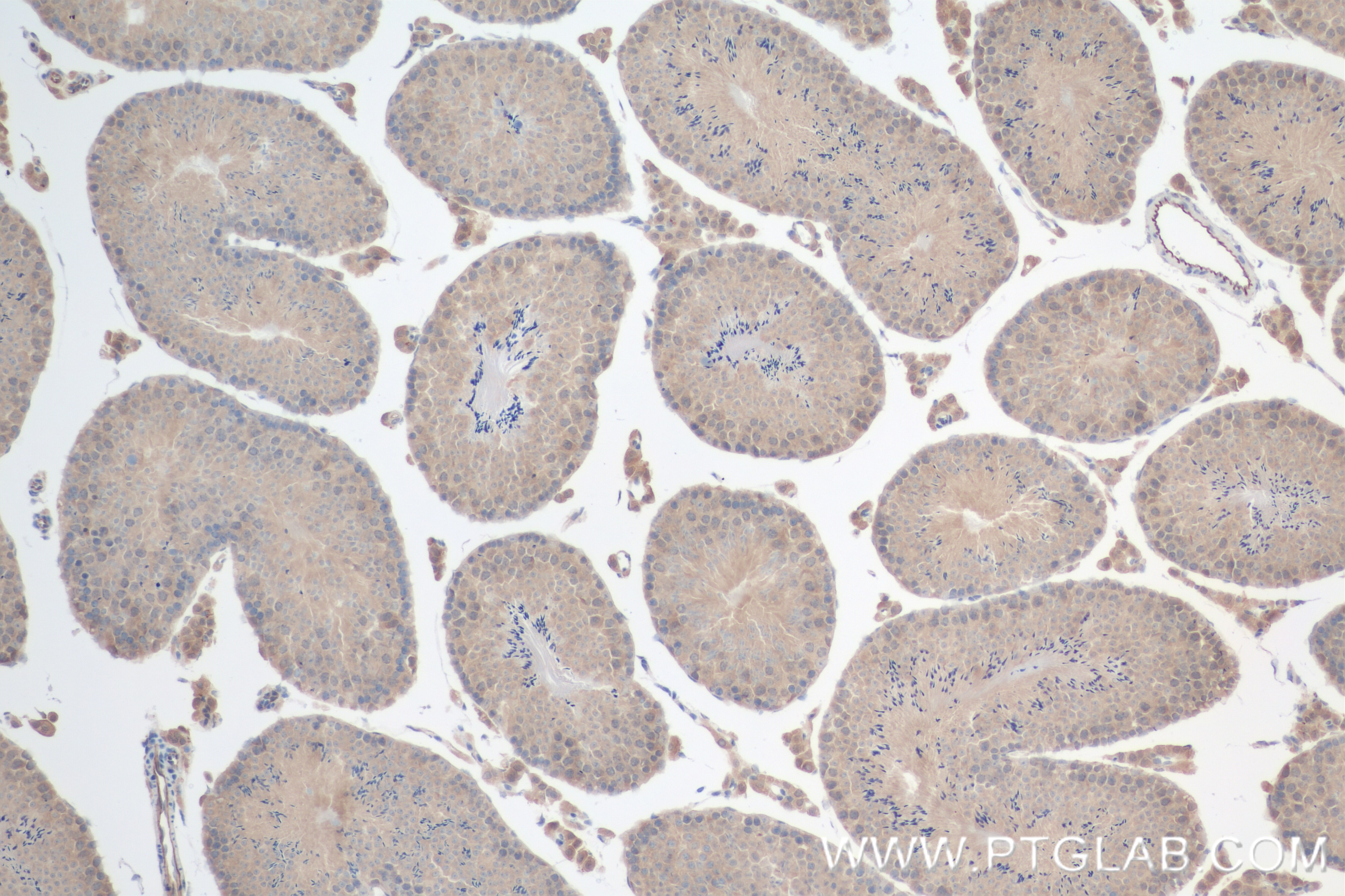 Immunohistochemistry (IHC) staining of mouse testis tissue using TTC9C Recombinant antibody (84611-2-RR)